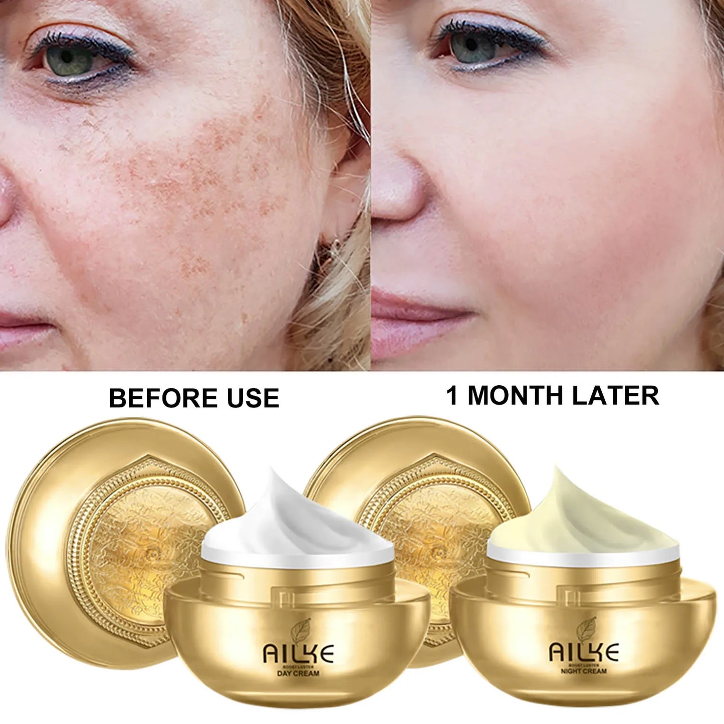 AILKE Whitening Dark Spots Removal Facial Cream With Collagen